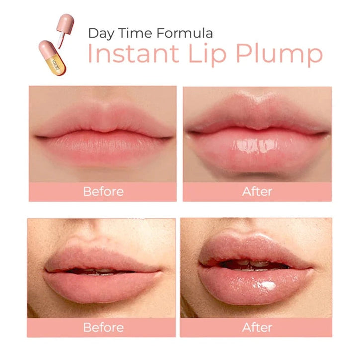 DE-ROL™ Lip Plumper - Kaufen Sie 1 und erhalten Sie 1 gratis!